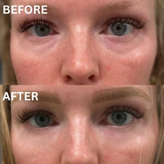 The Instant Firm Collagen Eye Patches