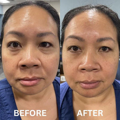 The Instant Firm Collagen Eye Patches
