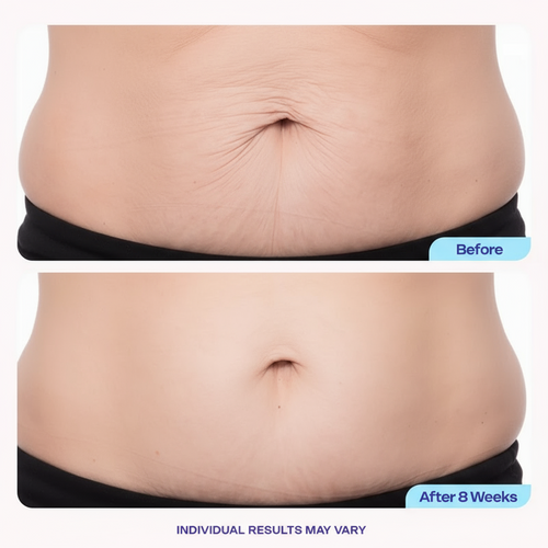 Tighten & Smooth Belly Firming Cream