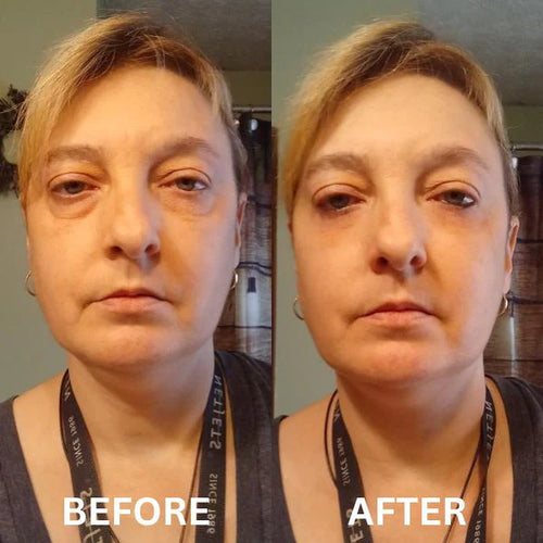 Instant Firm Collagen Eye Patches