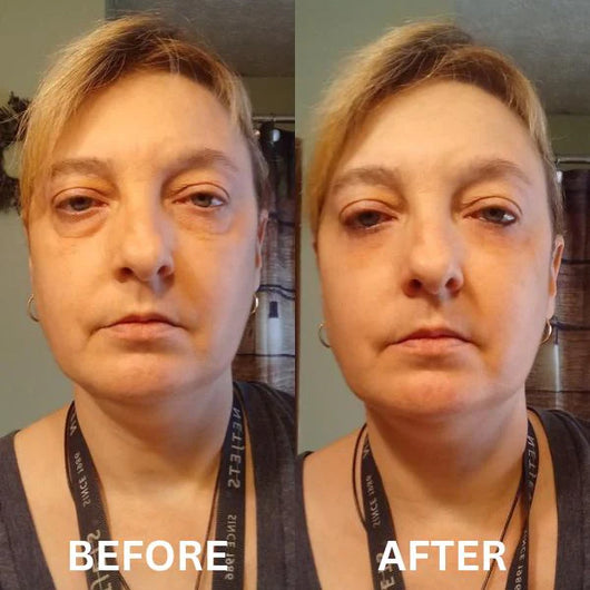 The Instant Firm Collagen Eye Patches
