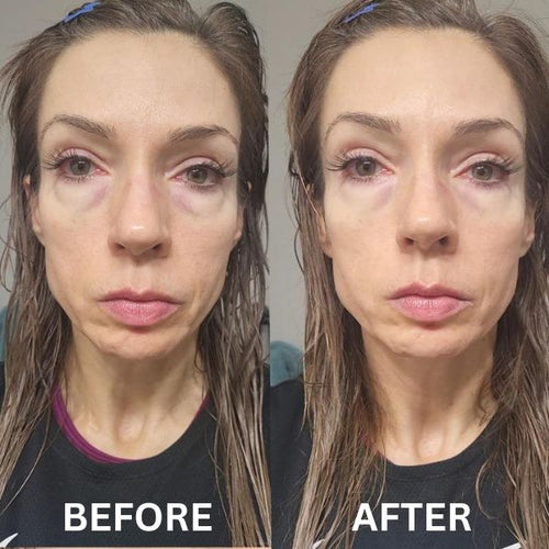 Instant Firm Collagen Eye Patches