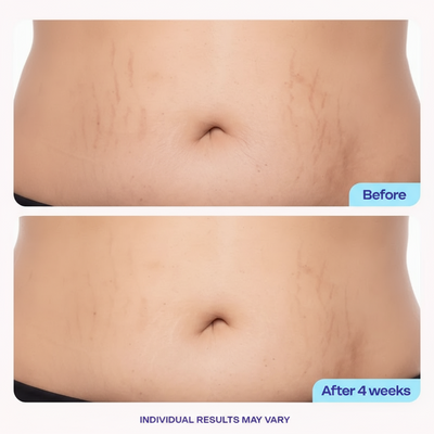 Tighten & Smooth Belly Firming Cream