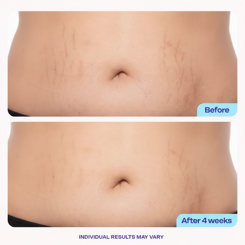 Tighten & Smooth Belly Firming Cream