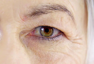 Tired, droopy-looking eyelids